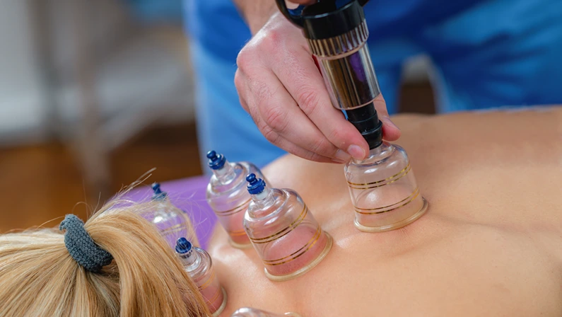 Woman undergoing cupping therapy on her neck during a physical therapy session. The suction cups are applied to improve circulation, relieve muscle tension, and promote healing for pain relief.
